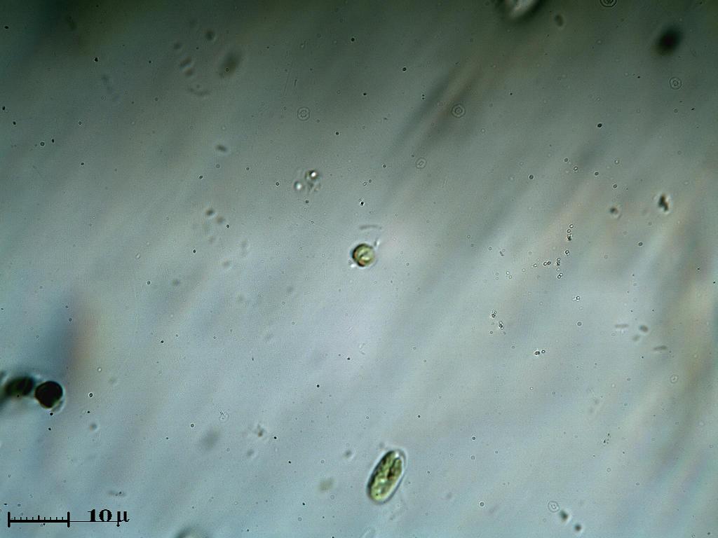 Piccolissima Euglenophycea con 2 occhi