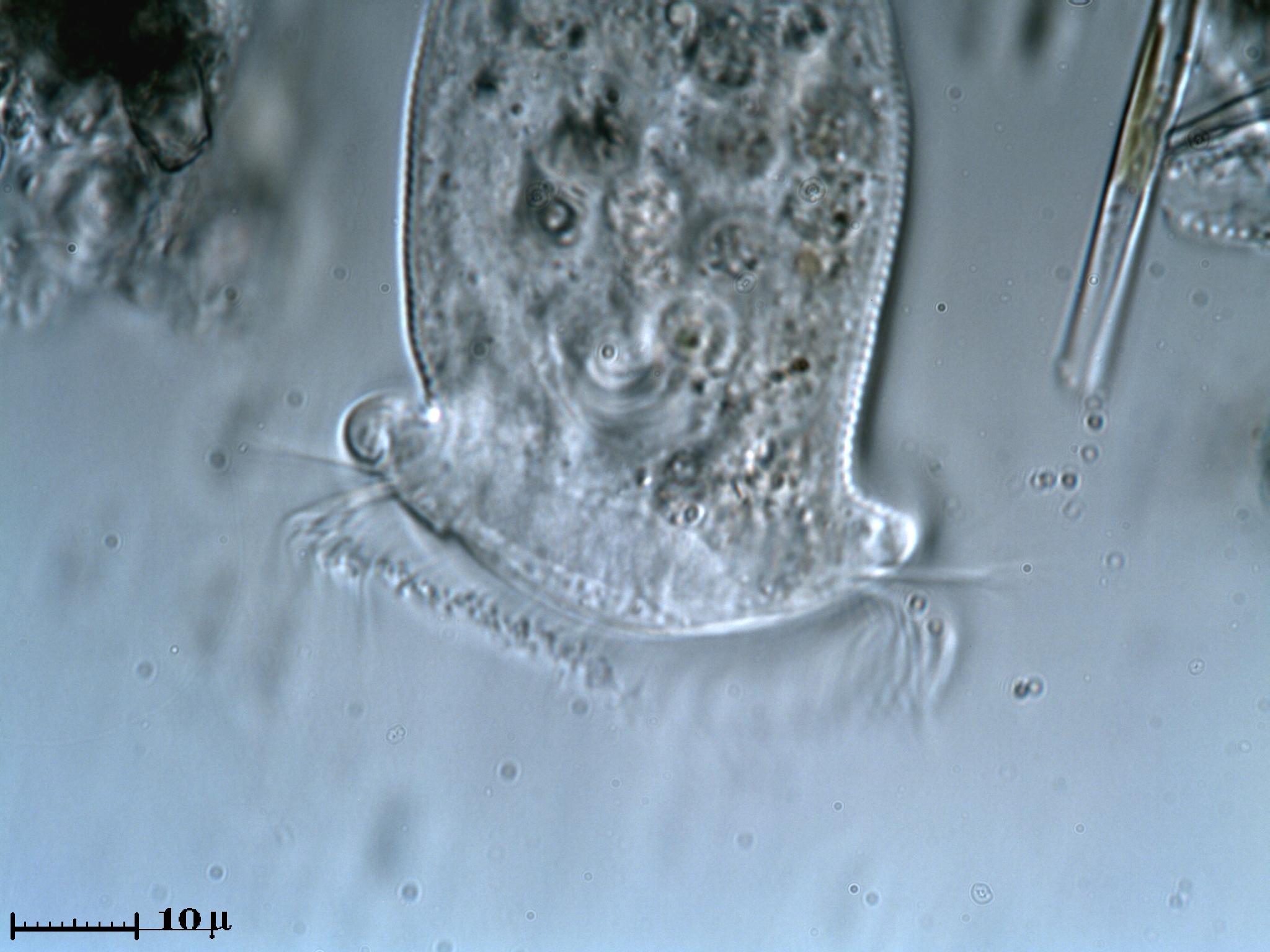 Vorticella