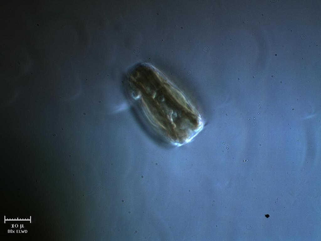 Surirella sp.