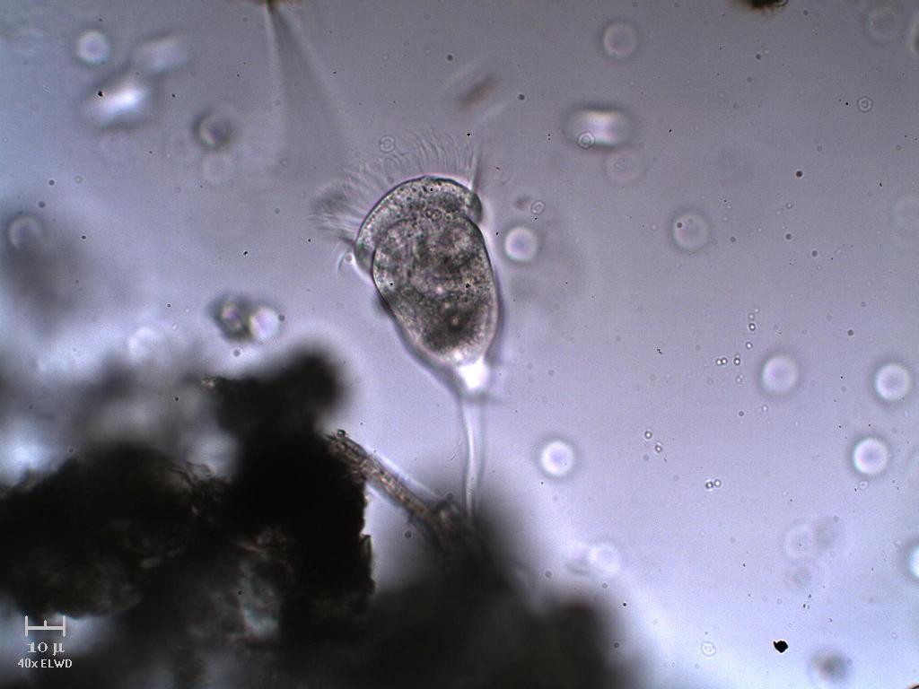 Vorticella