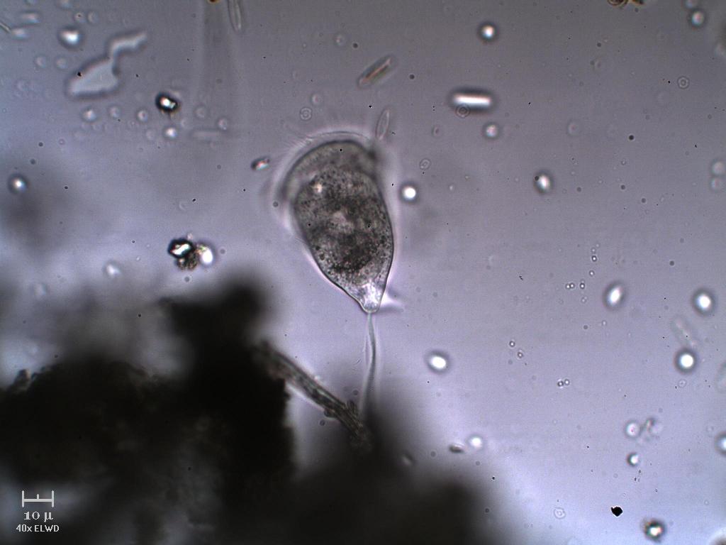 Vorticella