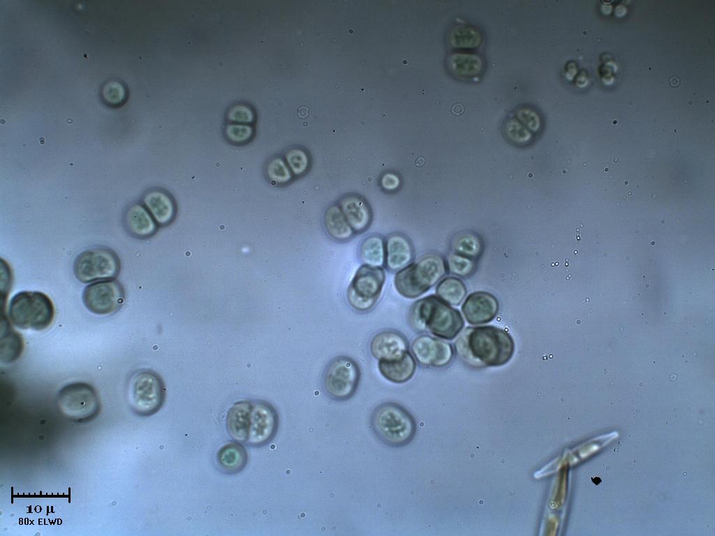 Chroococcus