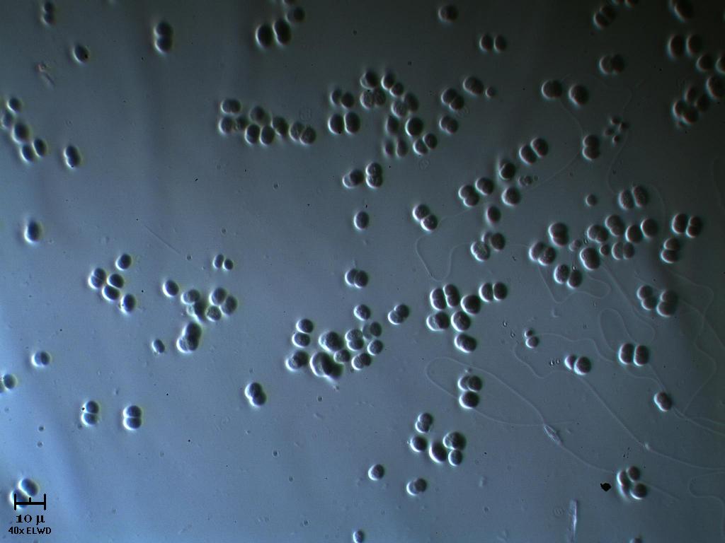 Chroococcus