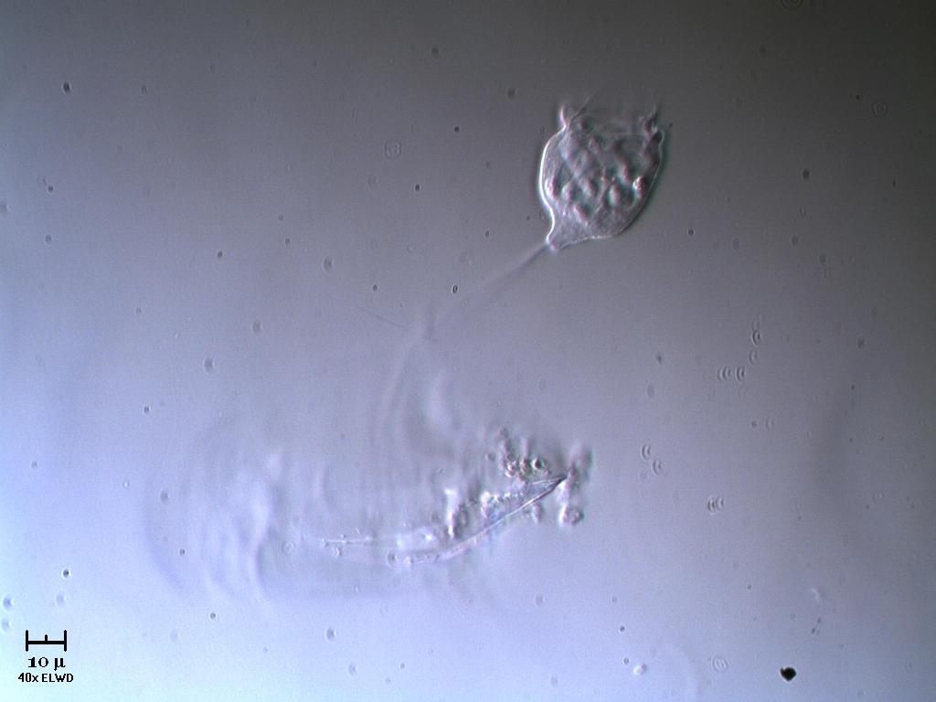 Vorticella 2