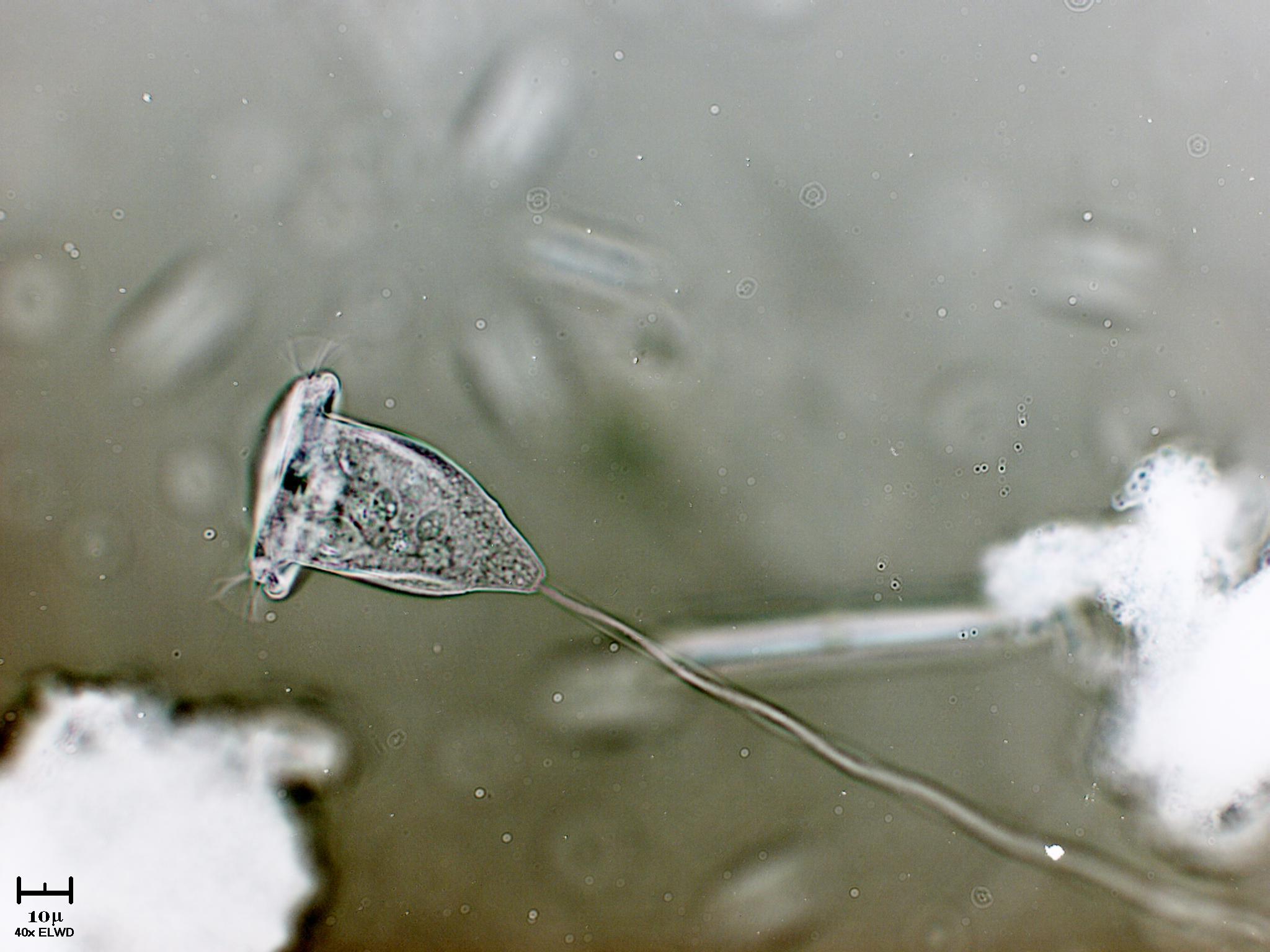 Vorticella