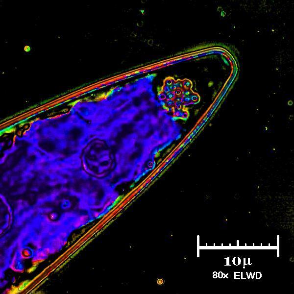 Micromatica di un Closterium