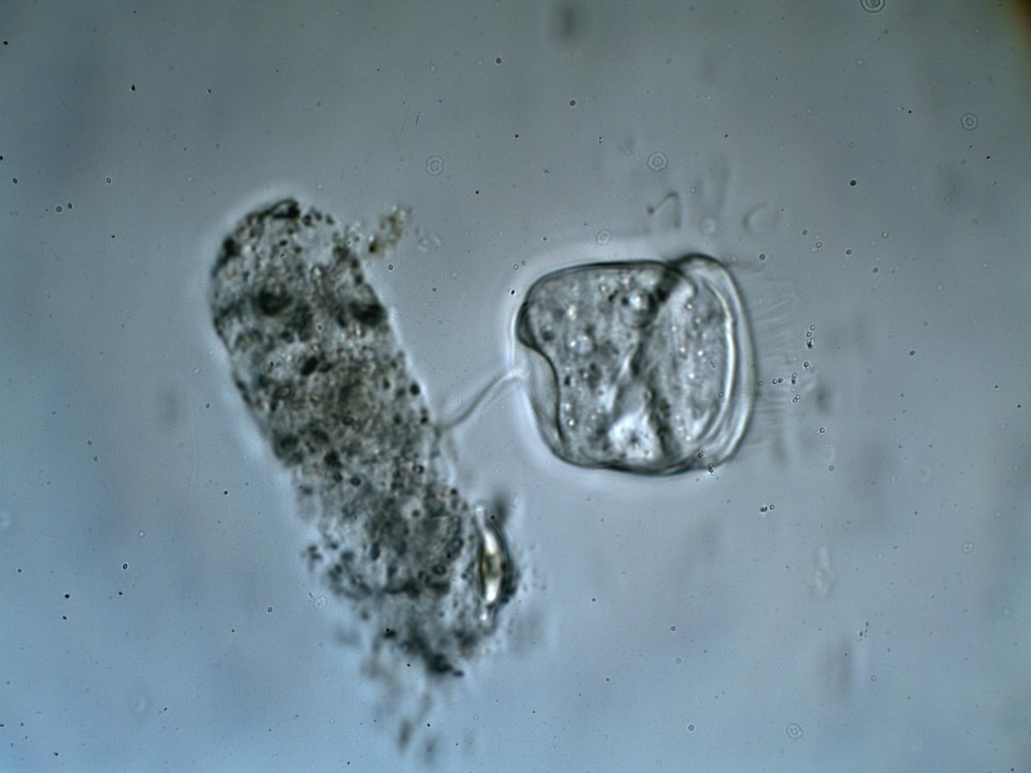 Vorticella