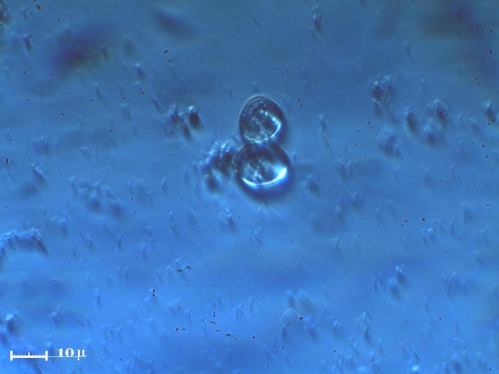 Episcopia in luce polarizzata