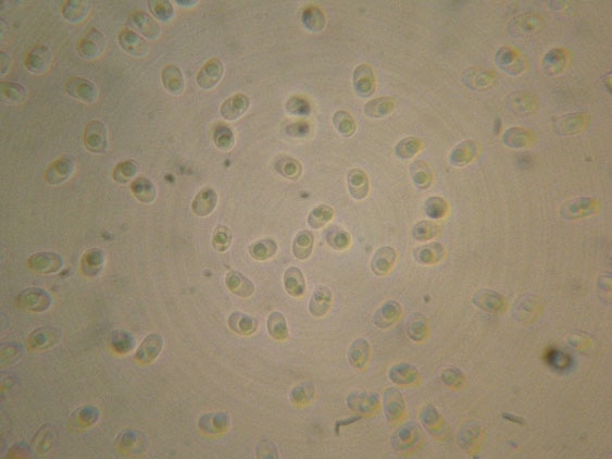 Aphyllophorales quiz (Schizopora flavipora)