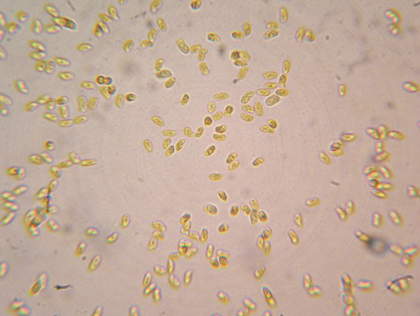 Aphyllophorales a 1500 metri di quota