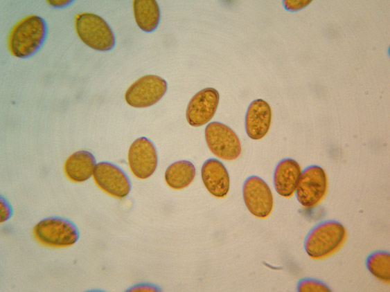 Microscopia sospetta Coniophora puteana (Coniophora puteana)