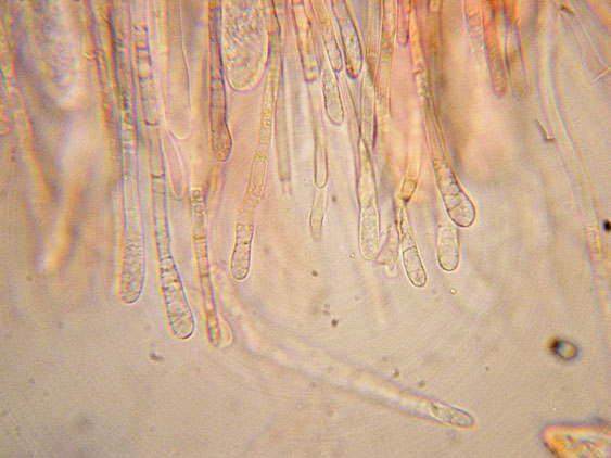 Lachnellula occidentalis (G.G. Hahn & Ayers) Dharne