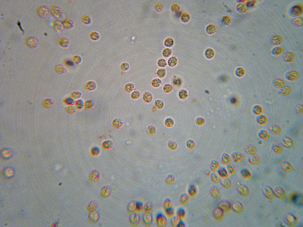 Aphyllophorales a 1500 metri di quota