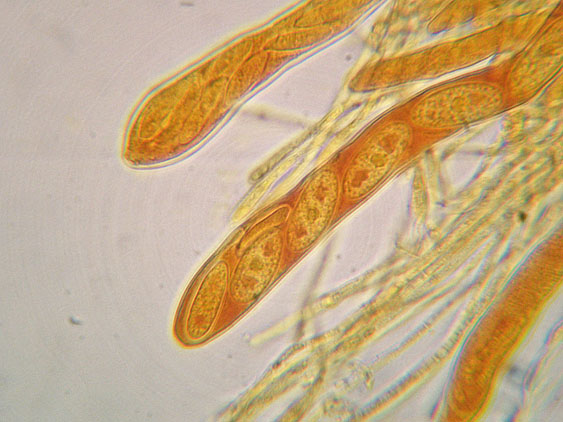 Lachnellula occidentalis (G.G. Hahn & Ayers) Dharne