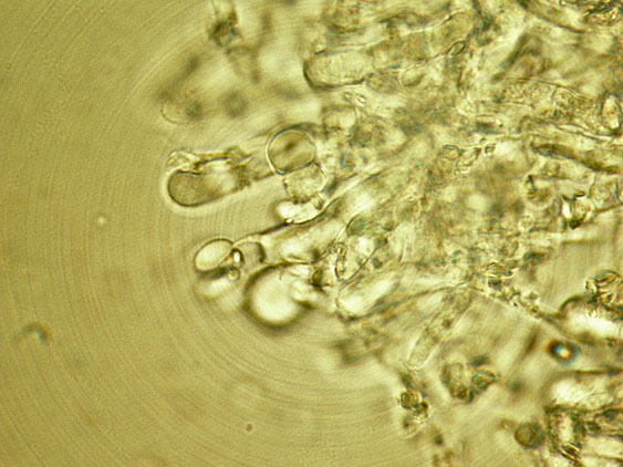 Due croste forse una su abete-foto0555(Hyphoderma setigerum)