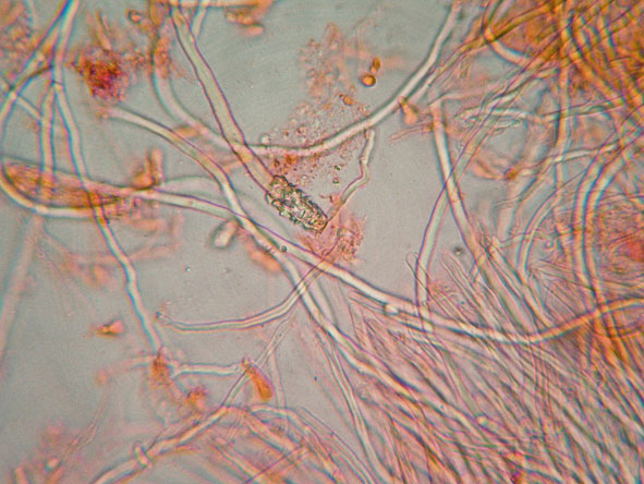 Aphyllophorales a 1500 metri di quota