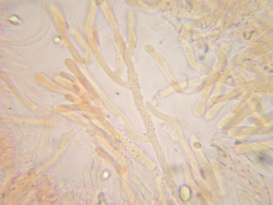 Da determinare (Ceraceomyces serpens)