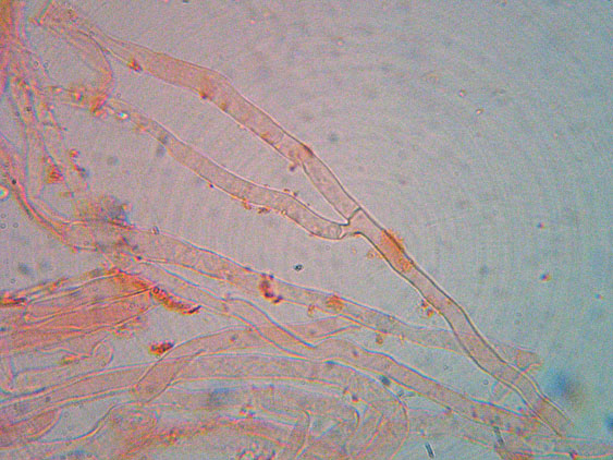 Intrusi tra gli  Aphyllophorales