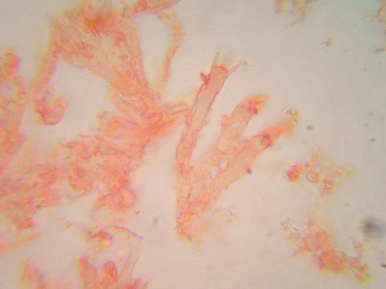 Piccola crosta su Ginestra (Hyphodontia juniper)