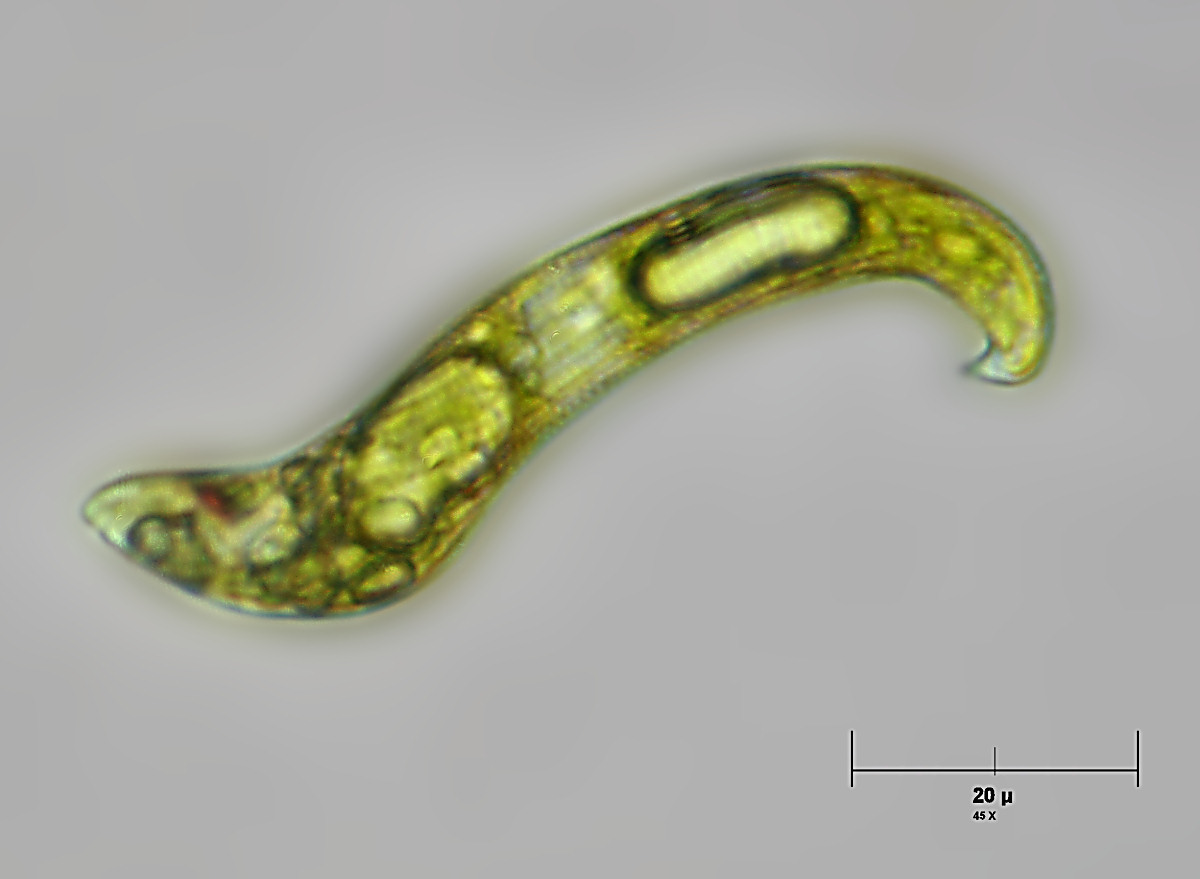 Euglena spirogyra ?