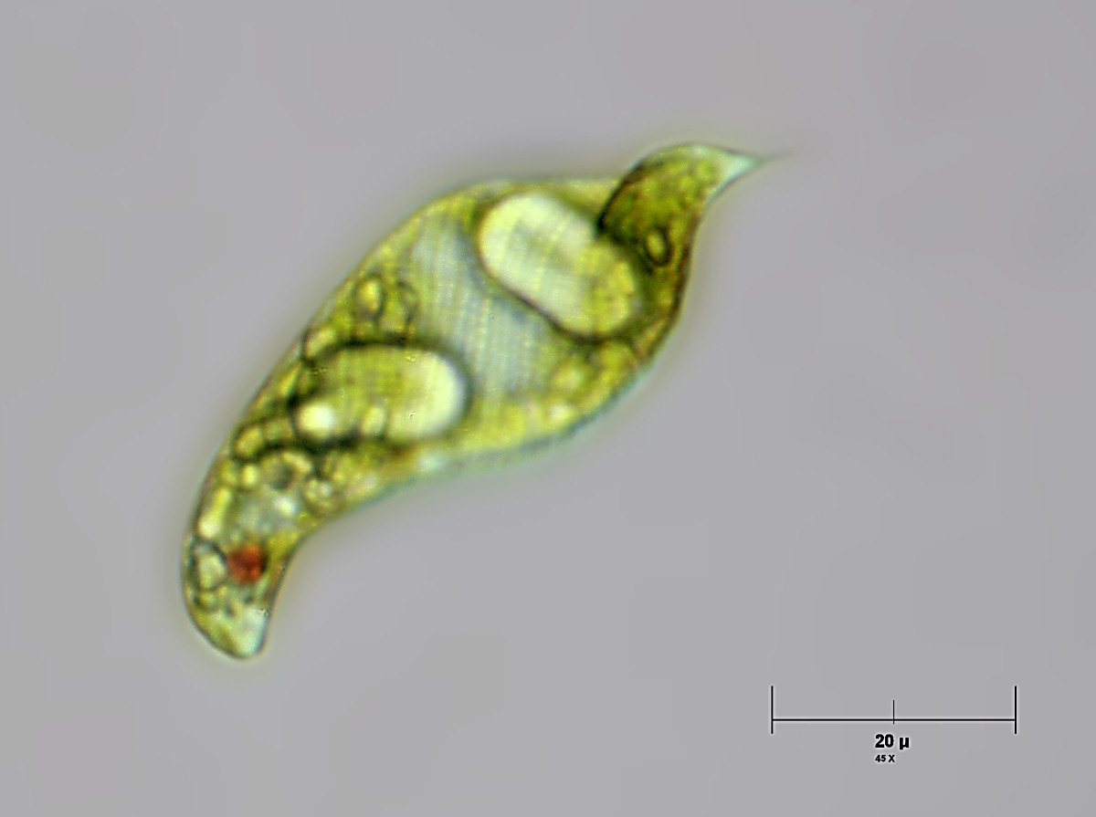 Euglena spirogyra ?