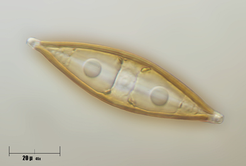 frustulia sp. ?????