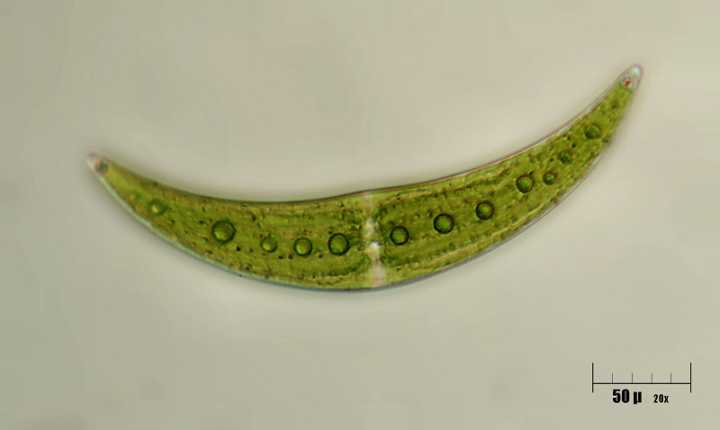 Closterium sp.