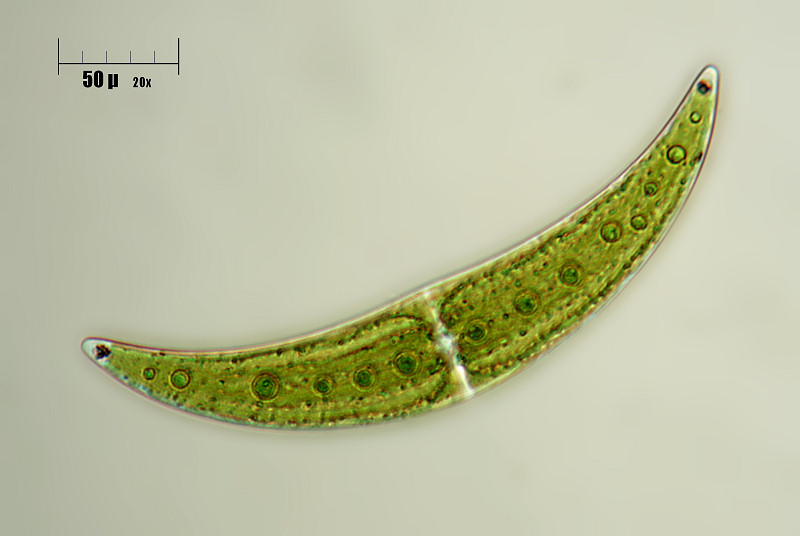 Closterium sp.