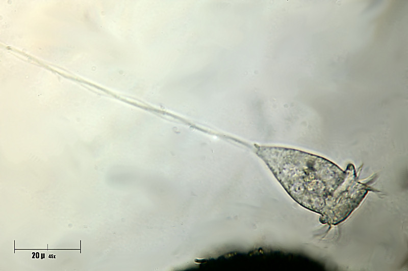 vorticella - particolare piede per Ang