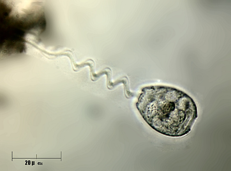 vorticella - particolare piede per Ang