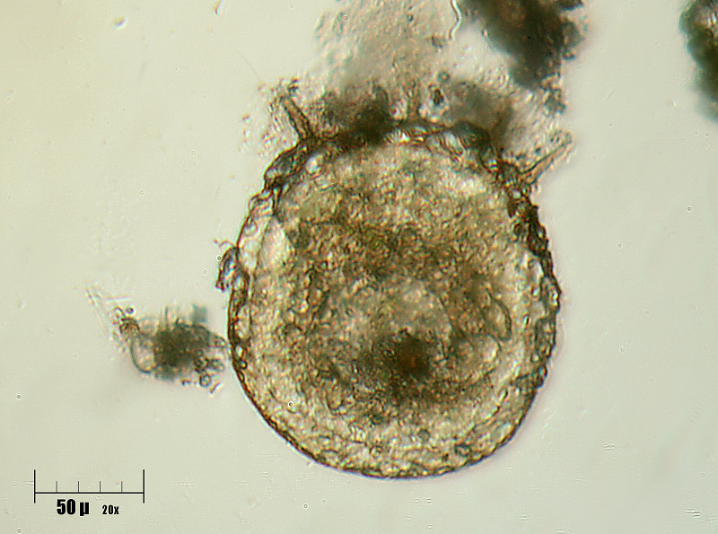 Tecameba - Centropyxis sp. ??