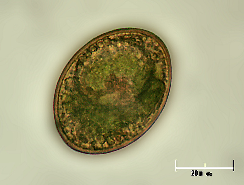 Surirella sp.  ???