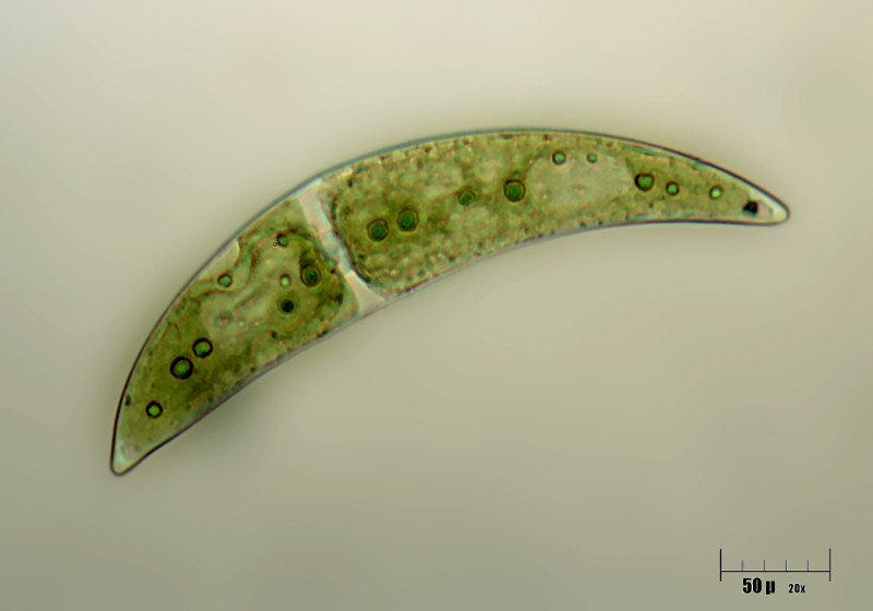 Closterium moniliferum