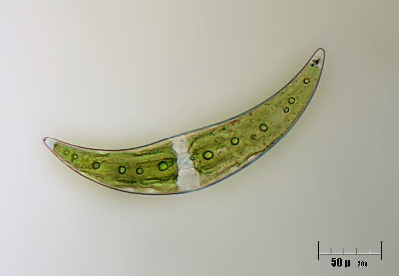 Closterium moniliferum