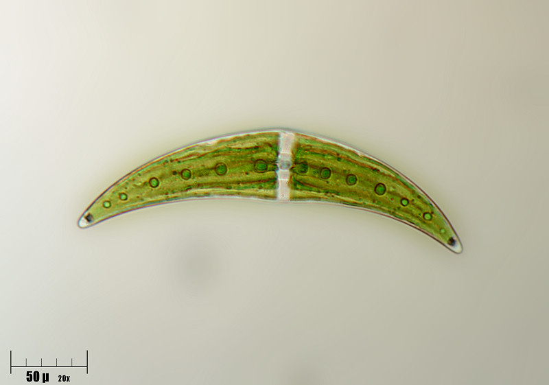 Closterium moniliferum 2