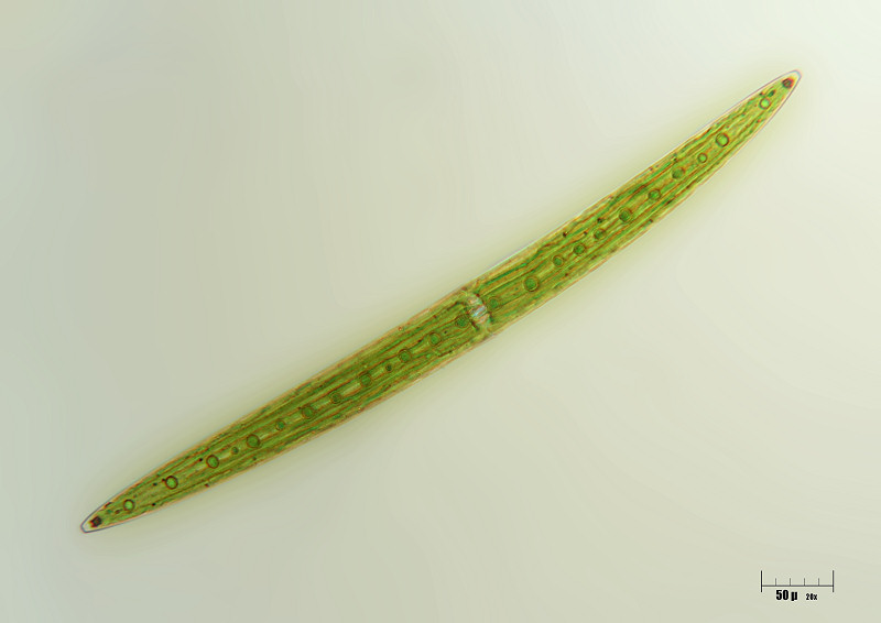 Closterium acerosum