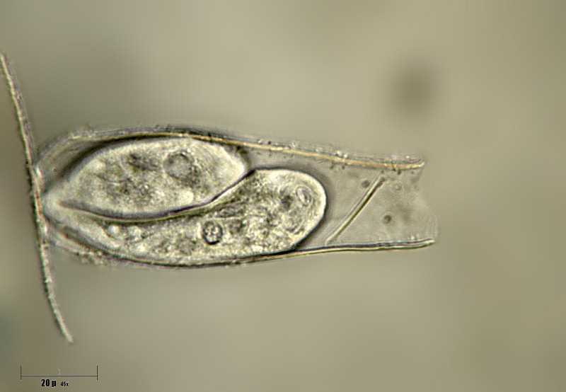 Thuricola operculata  -  coppia in una lorica