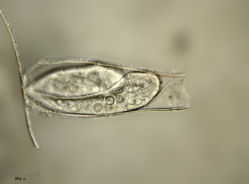 Thuricola operculata  -  coppia in una lorica