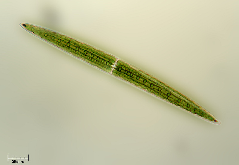 Closterium acerosum 2