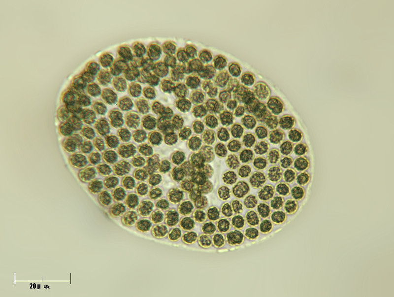 Microcystis sp.