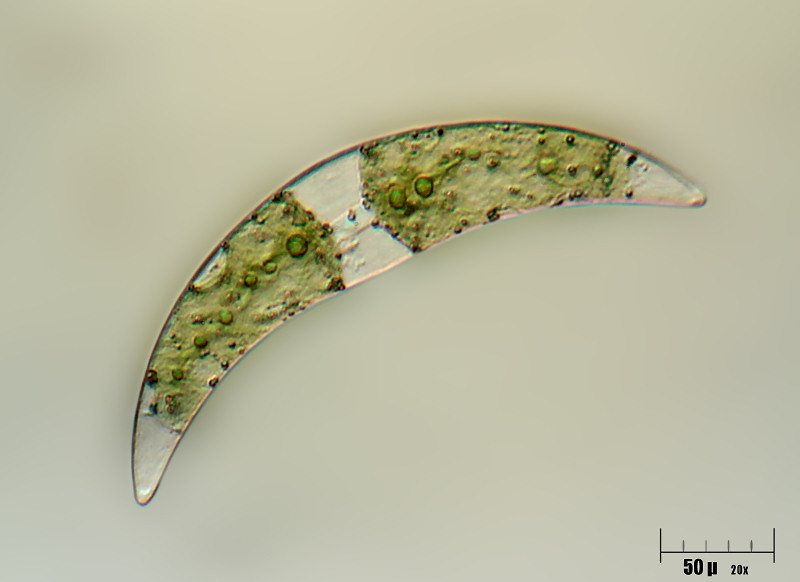 Closterium moniliferum