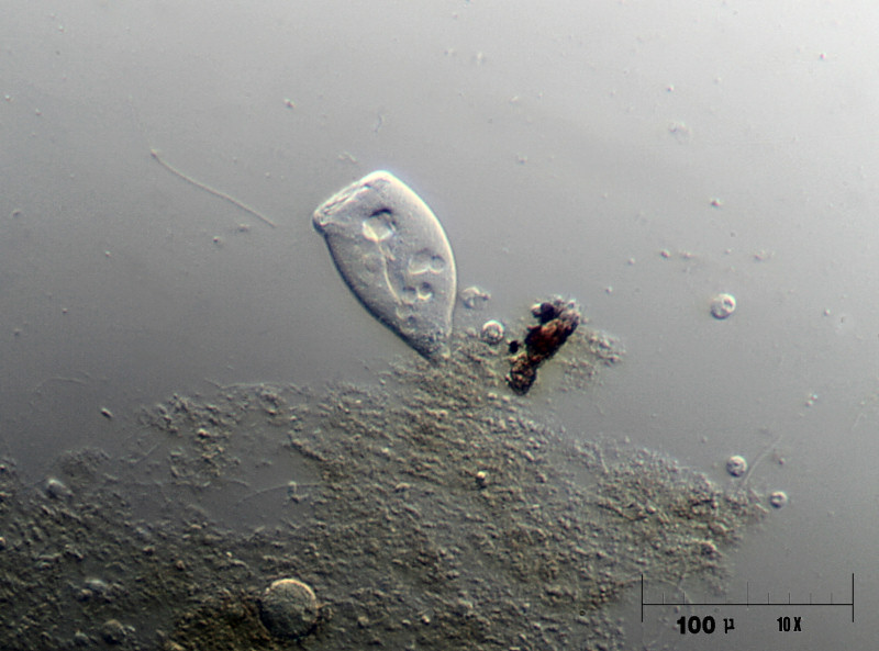 Vorticella sp.