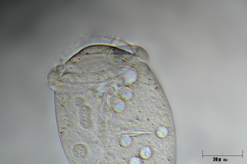 Vorticella sp 3