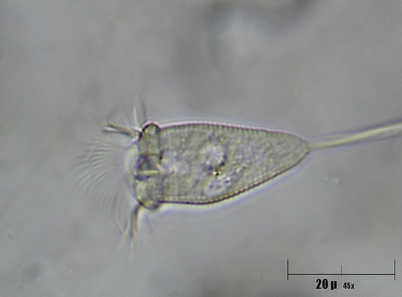 un''altra vorticella