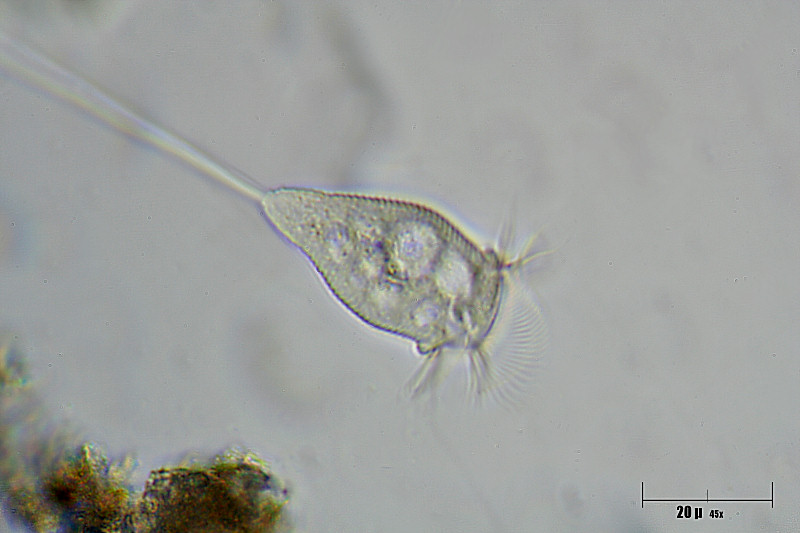 un''altra vorticella