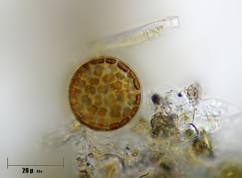 Cyclotella sp.