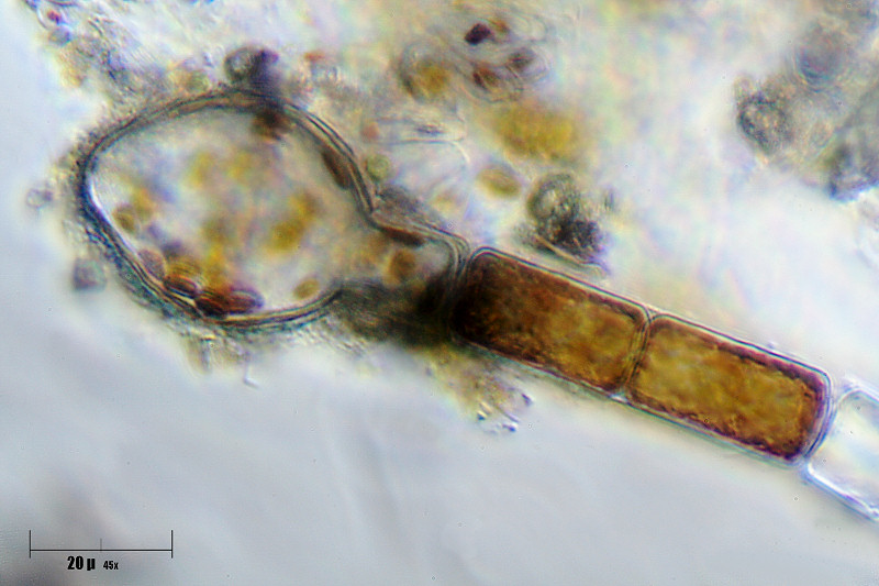 auxospora di Melosira varians