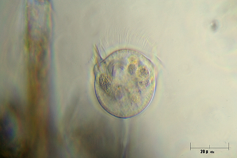 Vorticella sp.