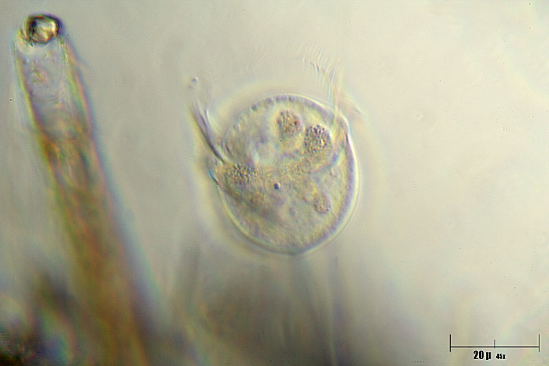 Vorticella sp.