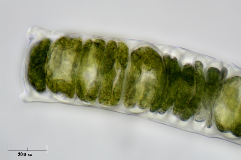 forse Microchaete sp. ? chi mi aiuta ?